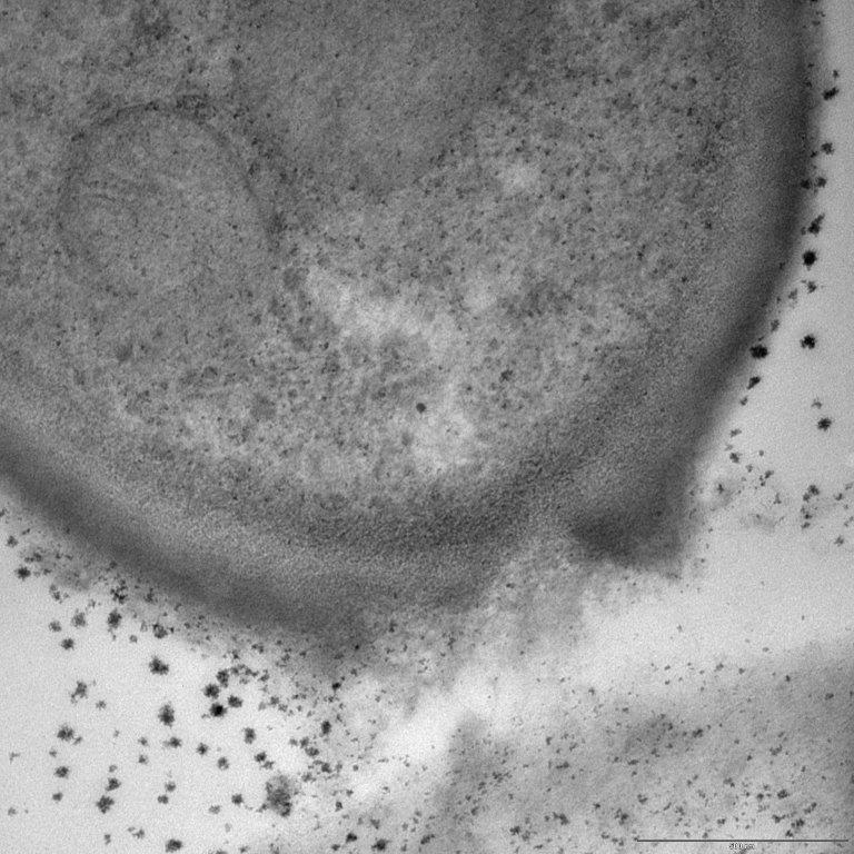 基于 Timorex Gold 植物提取物的生物杀真菌剂对患病细胞破裂的 Stockton 显微照片。图片来源：STK Bio-Ag Technologies